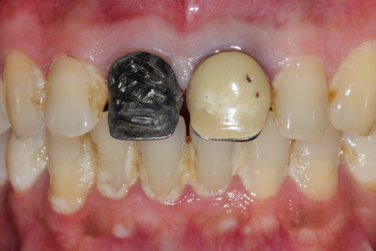 20230623_184940_0000 | Dental Krafts