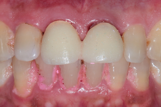 20230623_185012_0000 | Dental Krafts