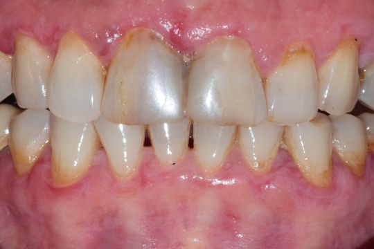 20230623_185111_0000 | Dental Krafts