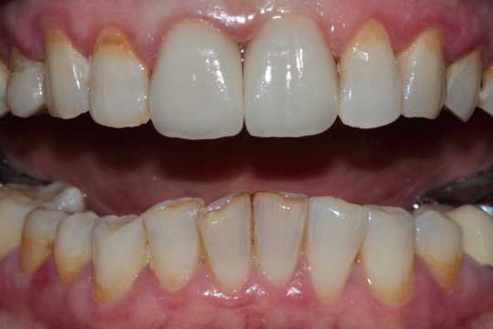 20230623_185144_0000 | Dental Krafts