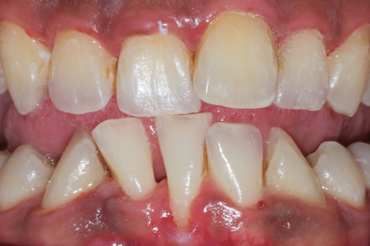 20230623_191609_0000 | Dental Krafts