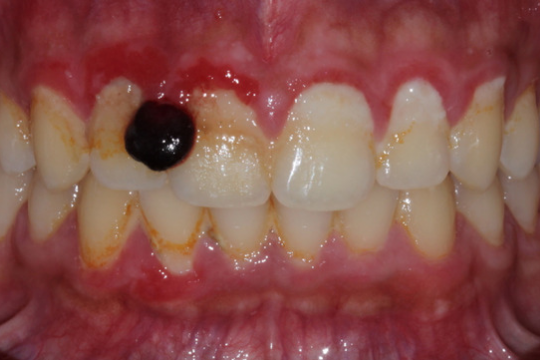 20230623_191657_0000 | Dental Krafts
