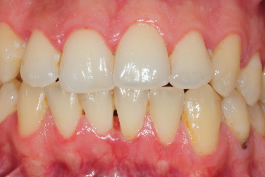 20230623_191745_0000 | Dental Krafts