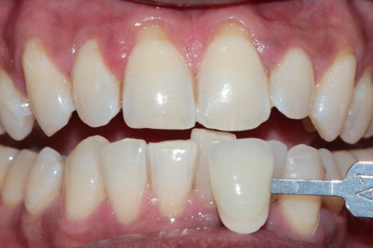 20230623_192723_0000 | Dental Krafts
