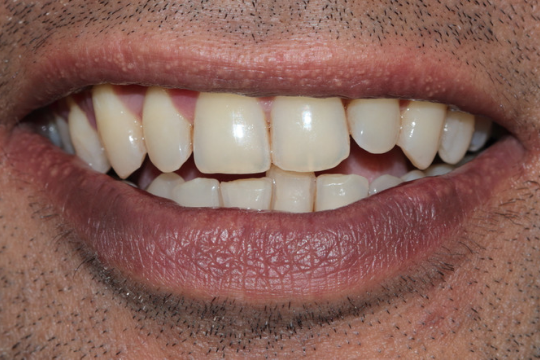 20230623_193115_0000 | Dental Krafts