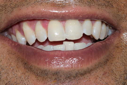 20230623_193604_0000 | Dental Krafts