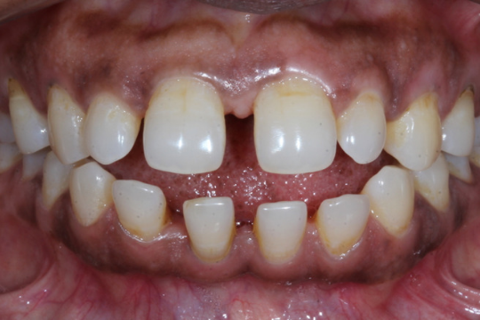 20230623_193930_0000 | Dental Krafts
