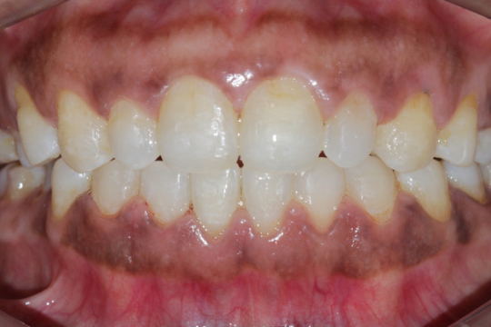 20230623_194015_0000 | Dental Krafts