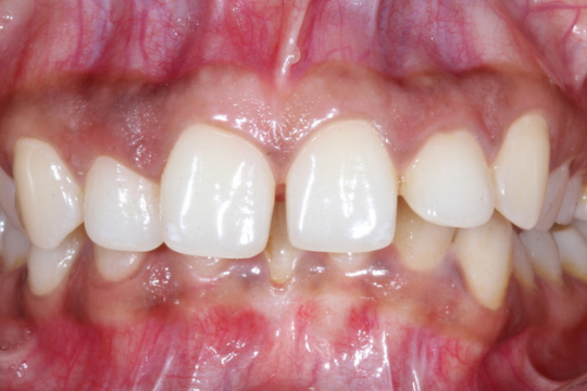 20230623_194110_0000 | Dental Krafts