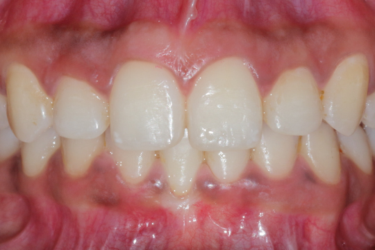 20230623_194143_0000 | Dental Krafts