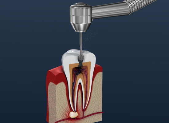 Untitled design (11) | Dental Krafts