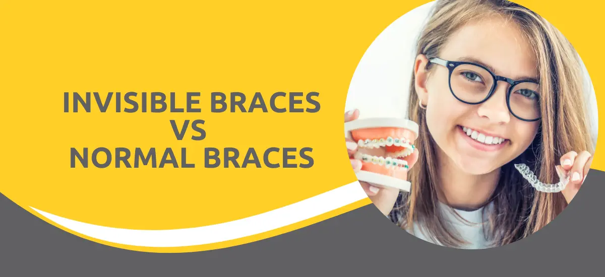 Invisible Braces vs Normal Braces