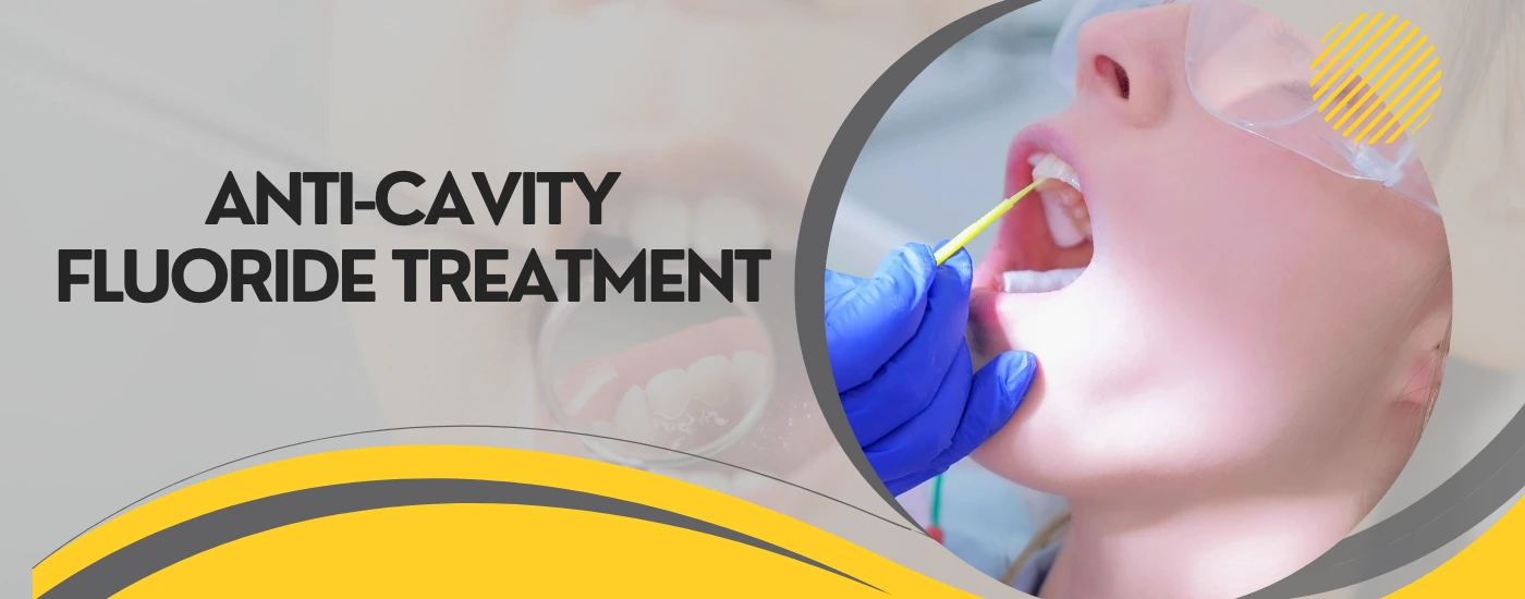 Anti-Cavity Fluoride Treatment | Dental Krafts
