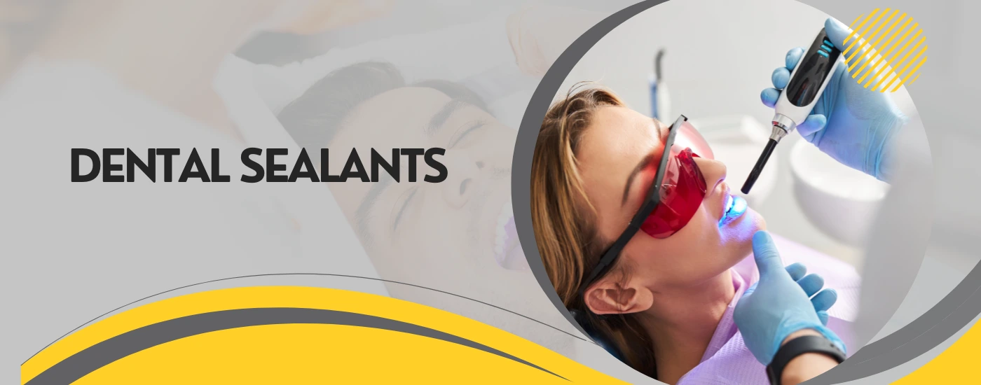 Dental Sealants | Dental Krafts
