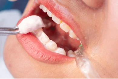 Picture1 | Dental Krafts