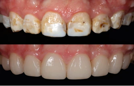 Picture2 | Dental Krafts