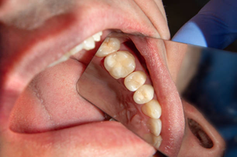 Picture3 | Dental Krafts