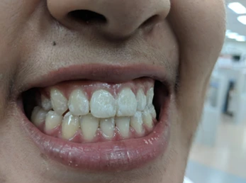 Picture3 | Dental Krafts