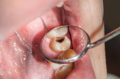 Picture2 | Dental Krafts