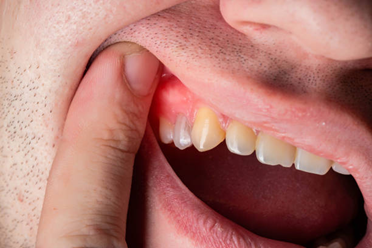Picture3 | Dental Krafts