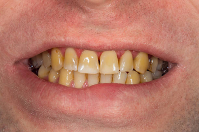 Picture3 | Dental Krafts