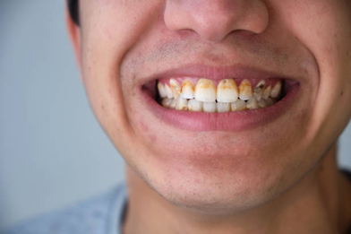 Picture4 | Dental Krafts