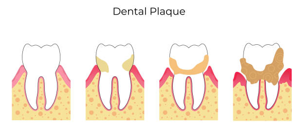 Picture52 | Dental Krafts