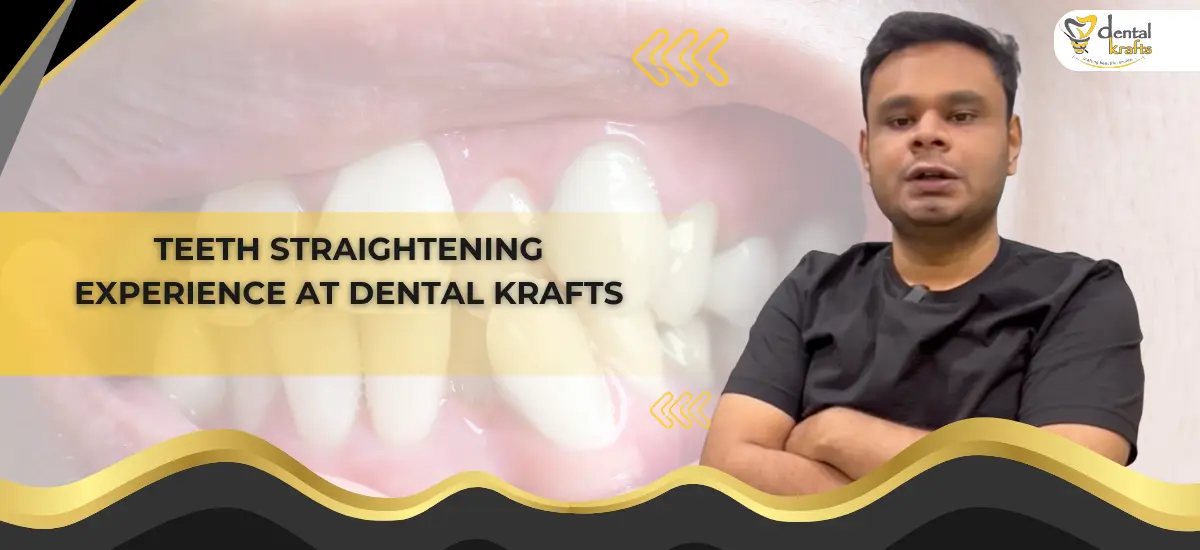 Teeth Straightening Experience At Dental Krafts | Dental Krafts