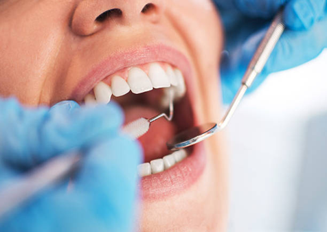 Picture2 | Dental Krafts