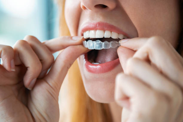 Picture21 | Dental Krafts